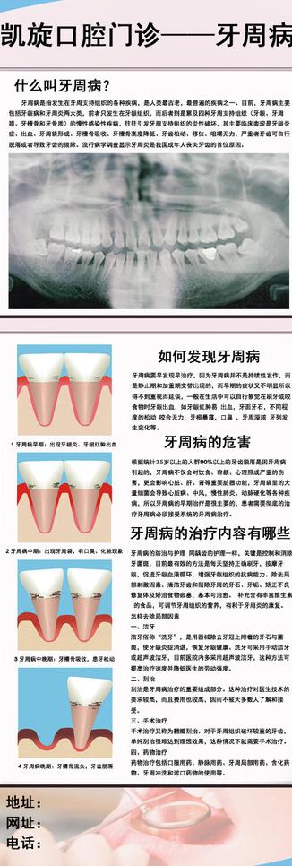 牙周病宣传x展架图片