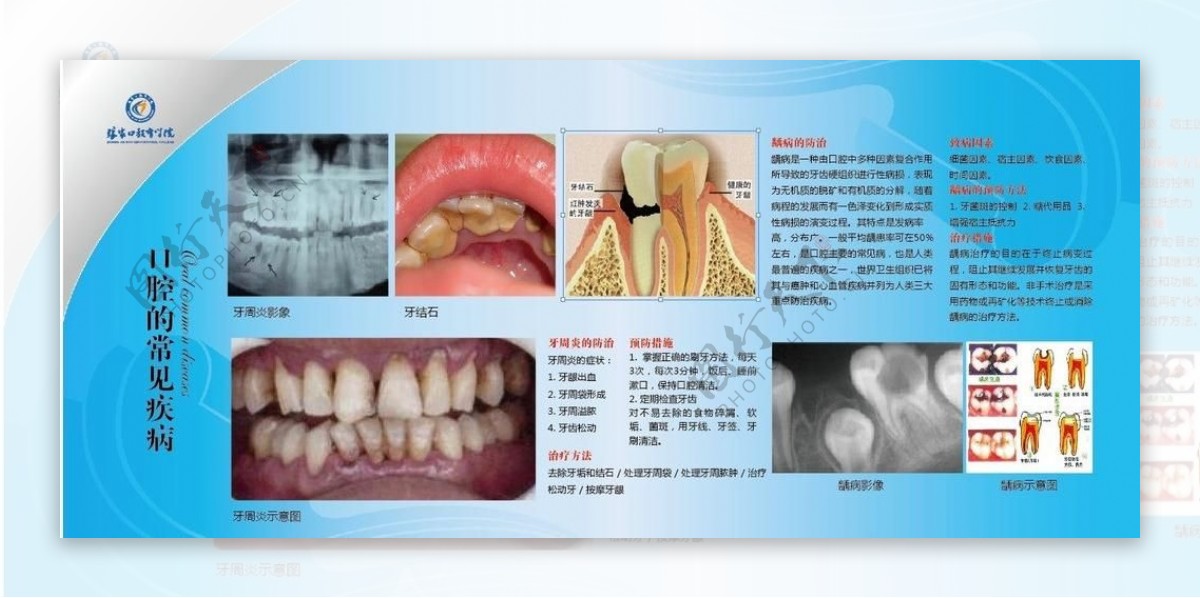 口腔的常见疾病图片
