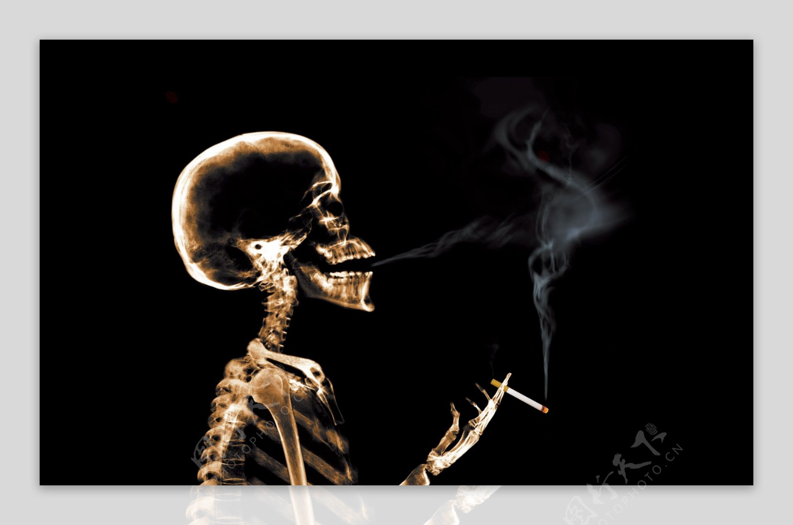 X光透视吸烟的人