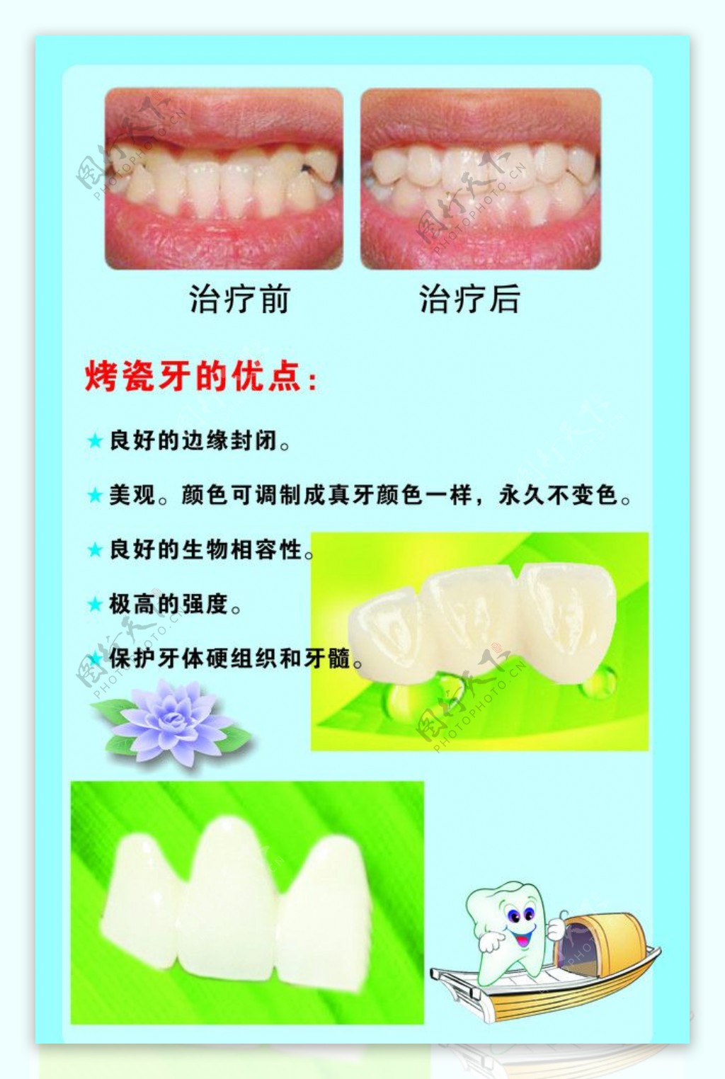 牙科KT板3图片