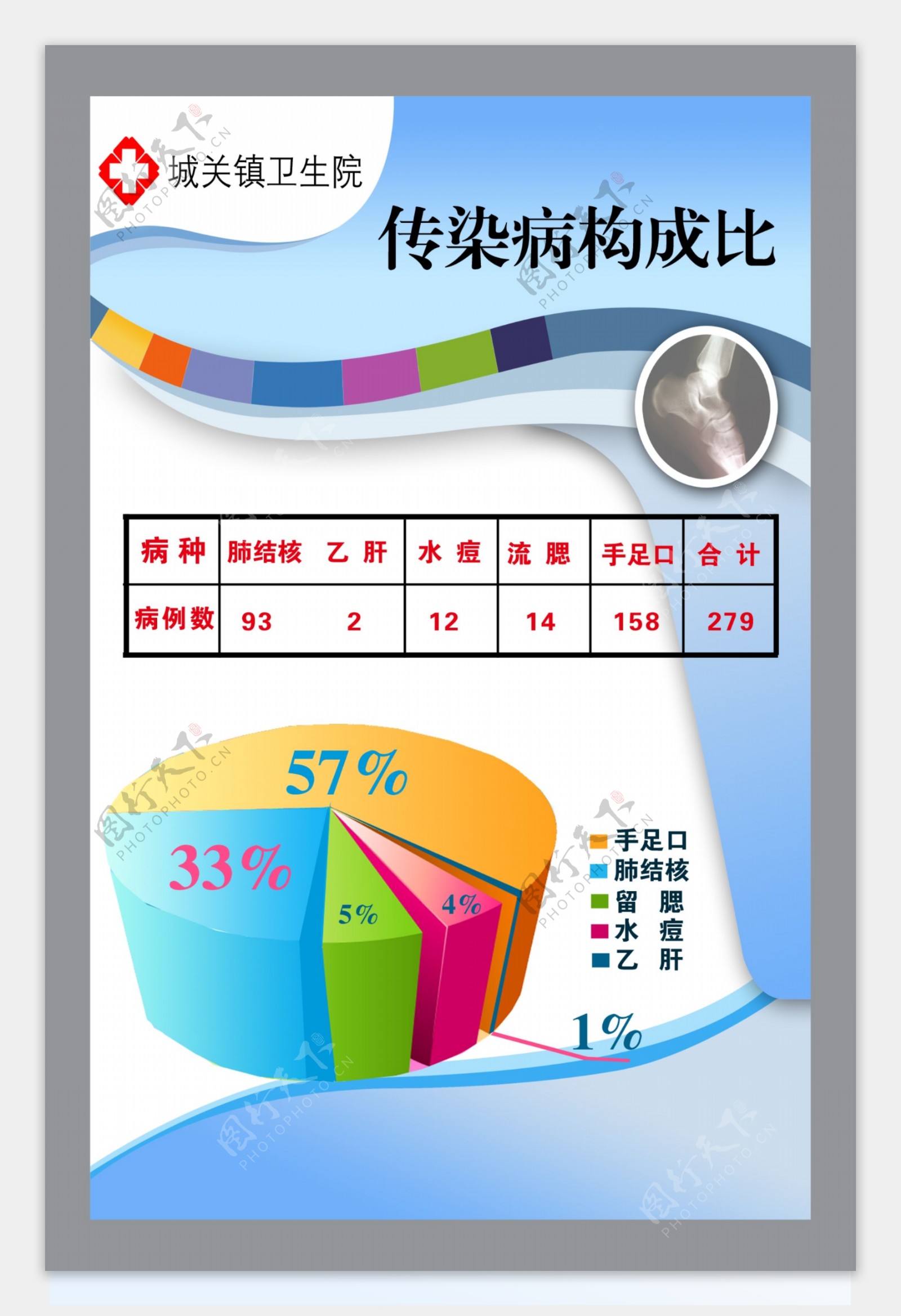 传染病构成比展板图片