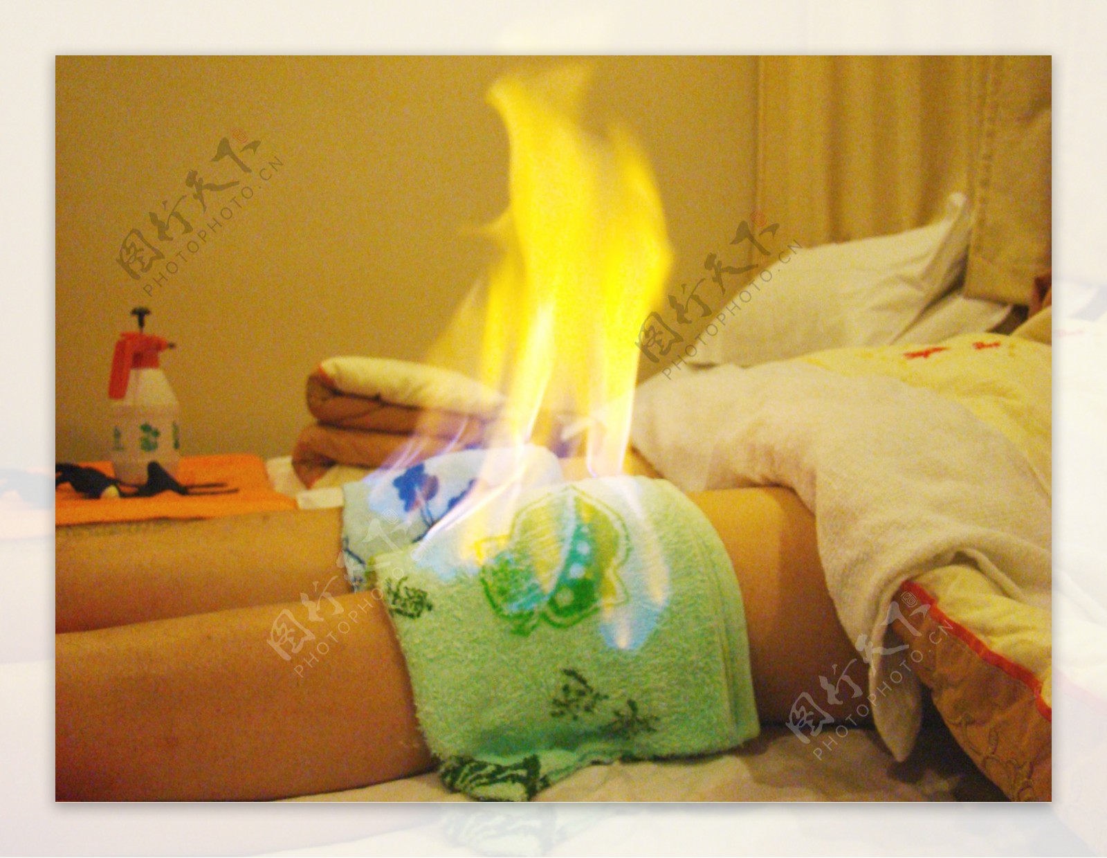 火疗膝盖图片