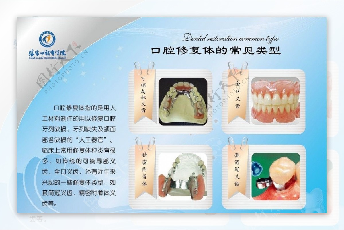 口腔修复体类型图片