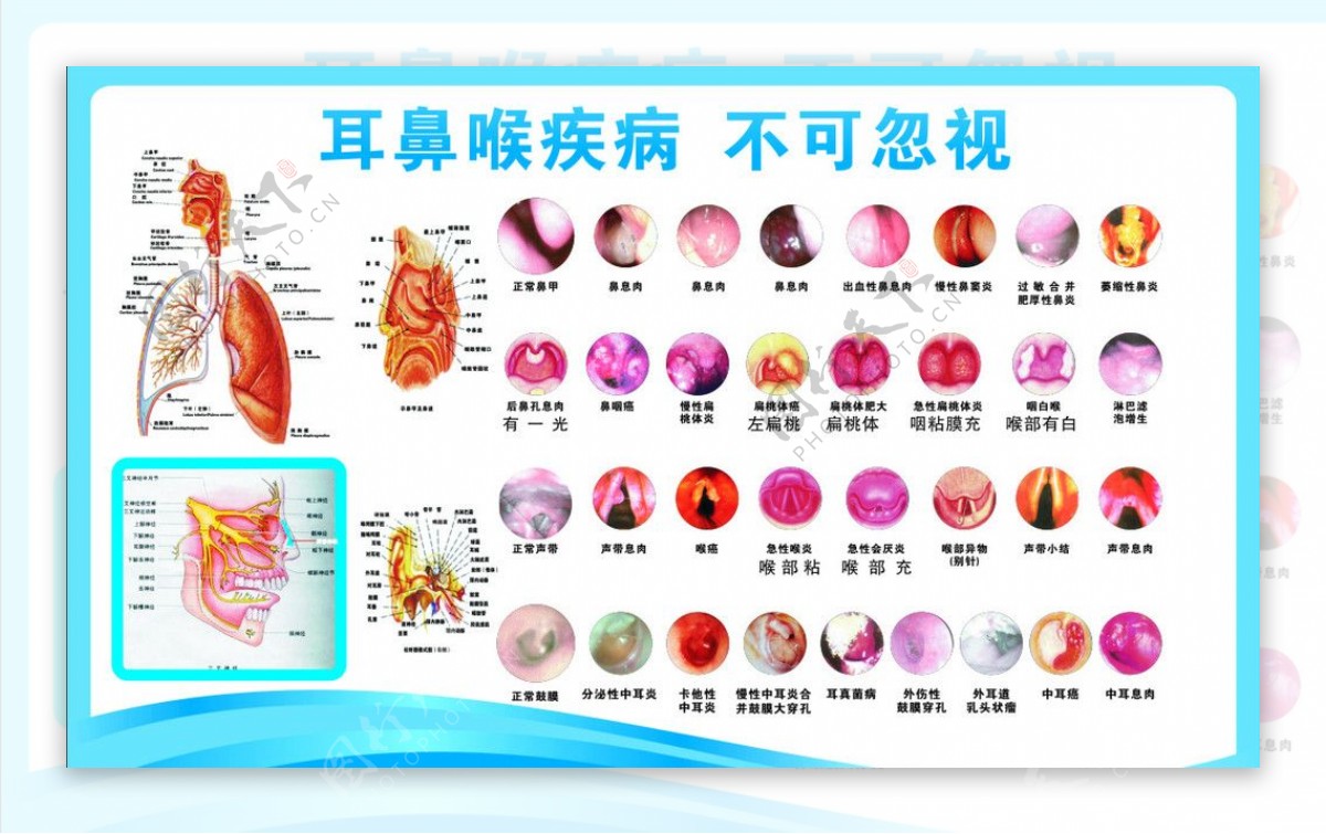 医疗展板耳鼻喉图片