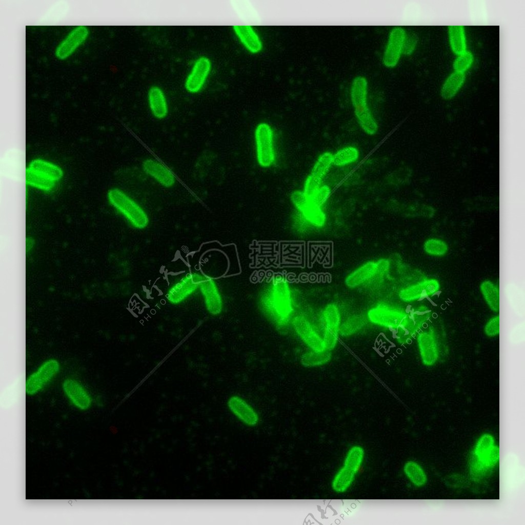鼠疫耶尔森氏菌直接荧光抗体染色DFA放大200倍