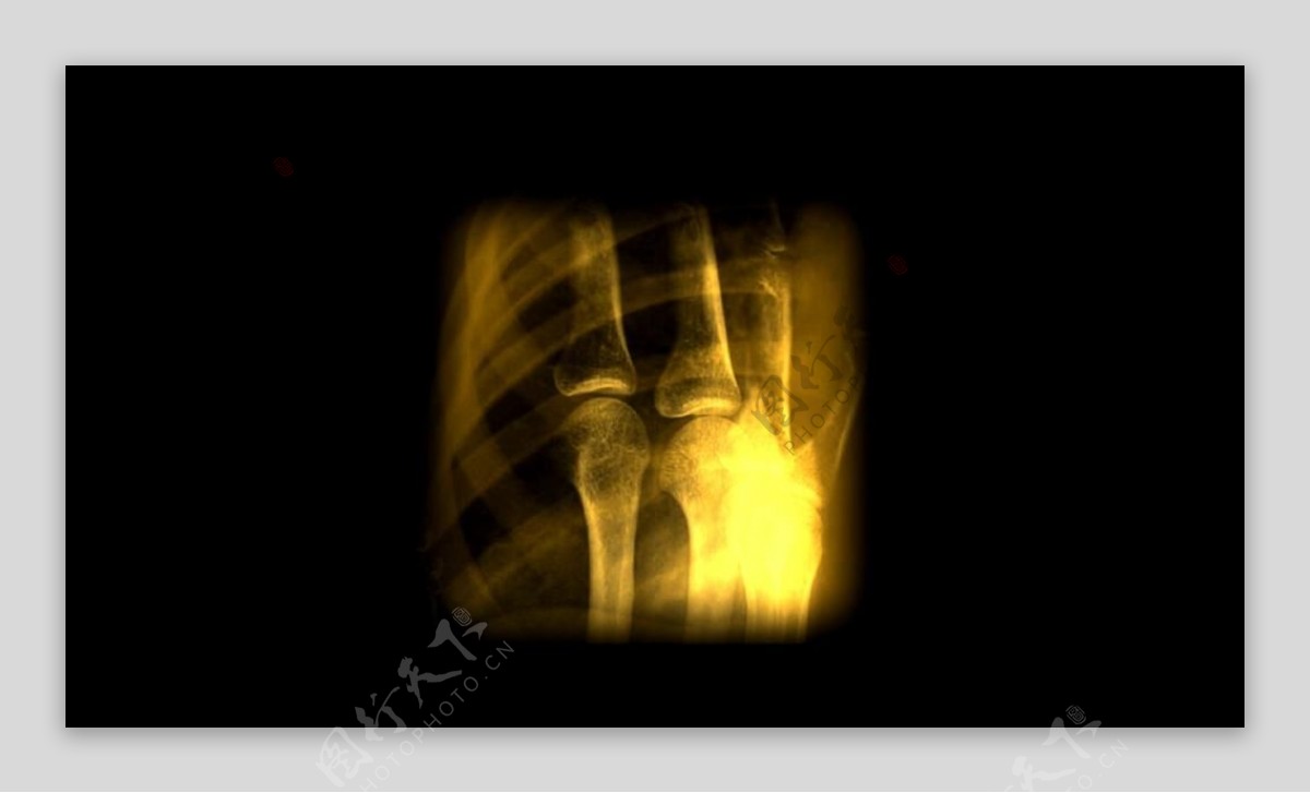X光人体扫描屏幕界面视频素材