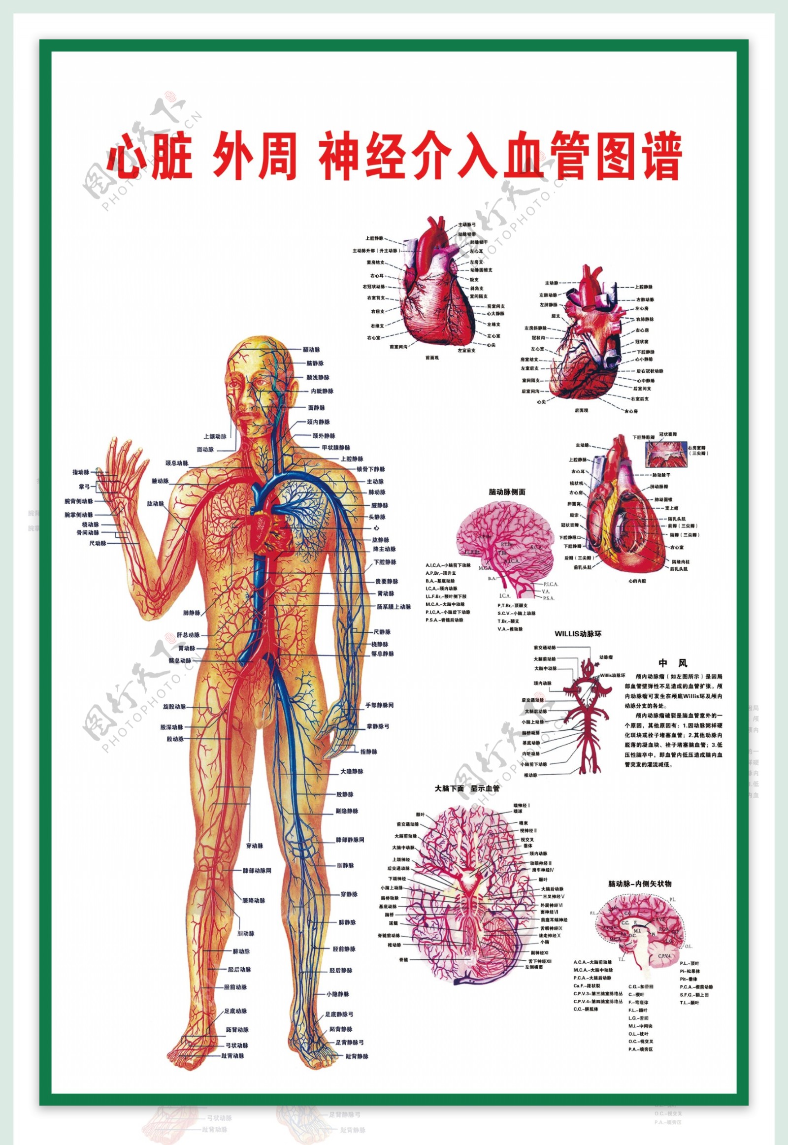 心脏神经介入血管图扫描图