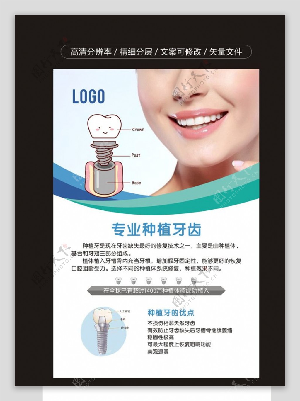 牙科海报牙科广告种植牙齿