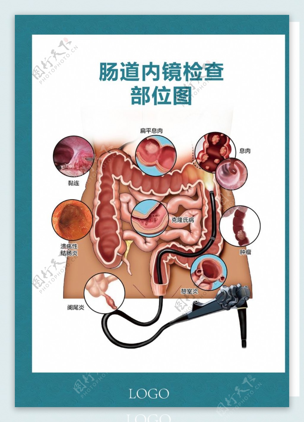 肠道内镜检查部位图图片